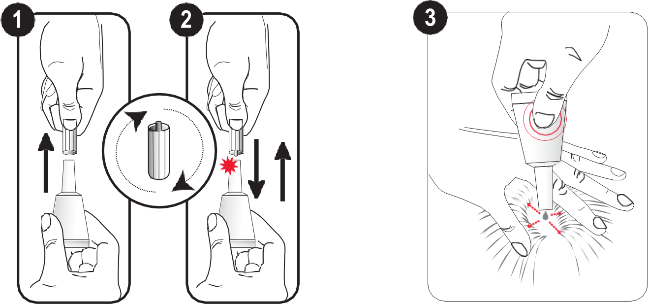 Evicto (< 2,5 kg) fig. 1